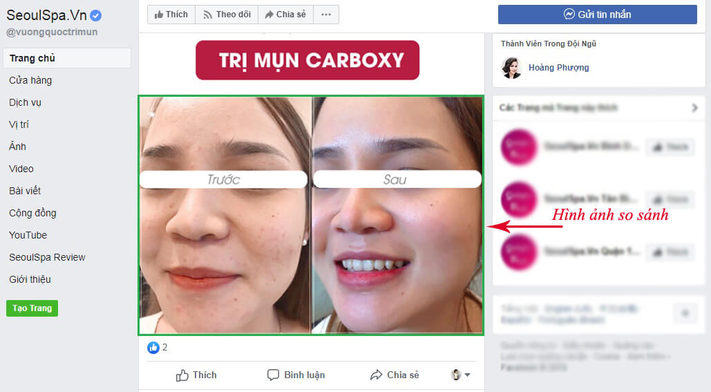 Lỗi quảng cáo Facebook so sanh trước sau